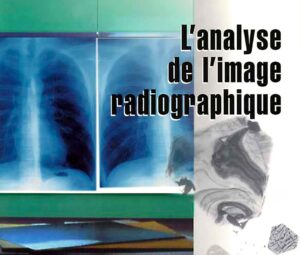 L’analyse de l’image radiographique - Image 1