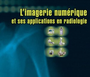 L’imagerie numérique et ses applications en radiologie - Image 1