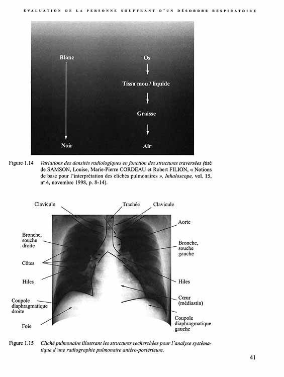 Thérapie respiratoire - Image 3