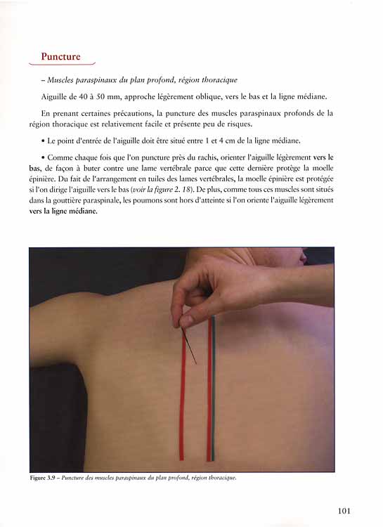 Points-détente et acupuncture, tome 2 - Image 3